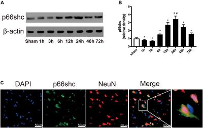 Carnosic Acid Mitigates Early Brain Injury After Subarachnoid Hemorrhage: Possible Involvement of the SIRT1/p66shc Signaling Pathway